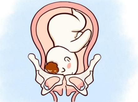 女性妊娠胎位低怎么办，日常注意调理是关键