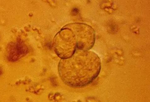 质量差的胚胎养囊成功之后并不是质量变好而是移植的成功率变高了！