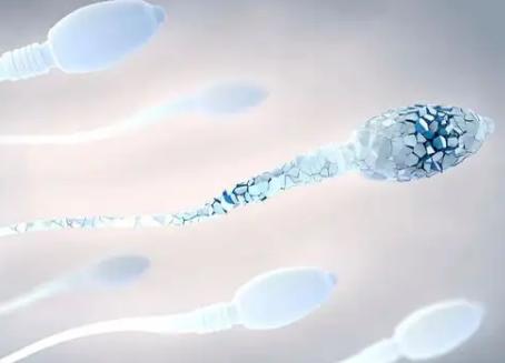 引起男性精液发黄的原因你都知道吗？