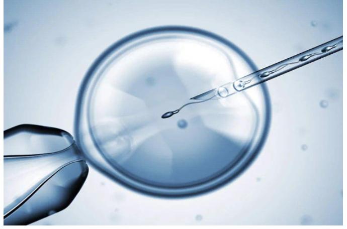 做辅助生殖哪里比较好？辅助生殖项目解析