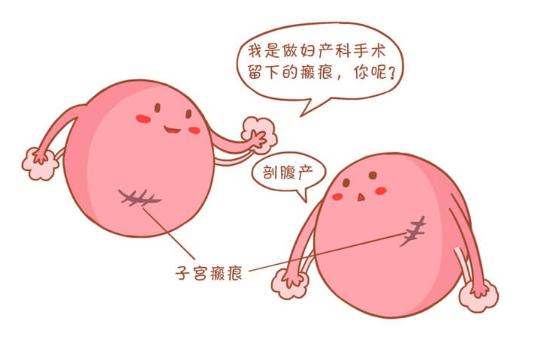 疤痕子宫怎么引起的?疤痕子宫可以二胎吗?