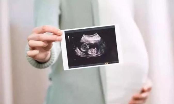 结扎了做b超能看出来吗?b超能查出是否结扎吗?