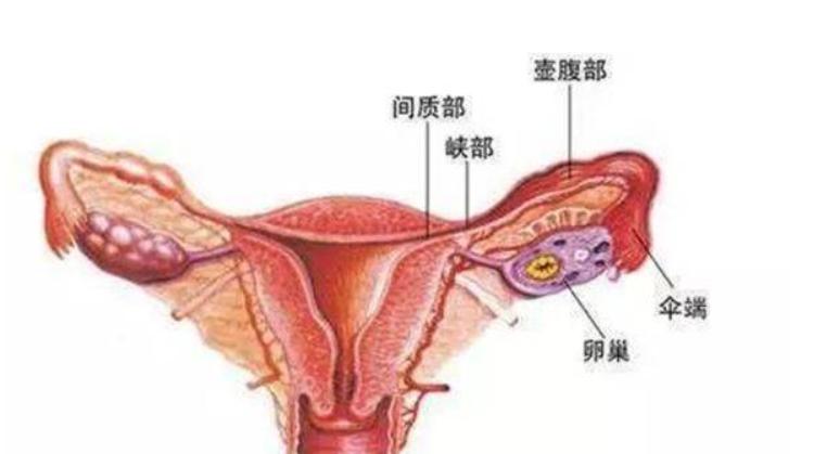 输卵管通畅但弥散欠佳怎么回事?输卵管通畅但弥散欠佳怎么治疗?
