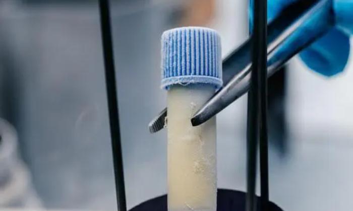 冷冻精多少钱一年?精子冷冻保存的价格