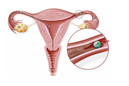 输卵管造影前塞药了要紧吗?输卵管造影对身体有什么伤害?