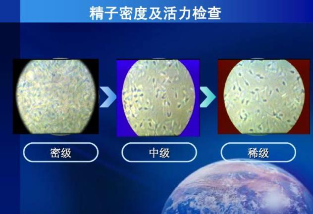 三代试管生子总活力只有30%比较严重，建议从这些方面着手治疗