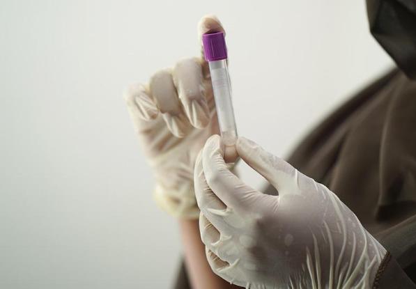 男士不孕一定要立马去做检查，附所有检查项目费用明细