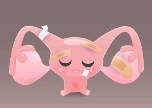 卵巢功能失调能通过针灸调理吗？可以起到改善作用