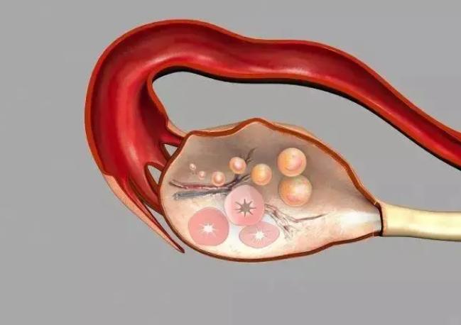 输卵管堵塞手术费用约为5千-2万，具体多少要看这几个方面