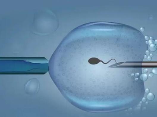 枣庄试管医院技术可以助孕,有效的控制男女比例
