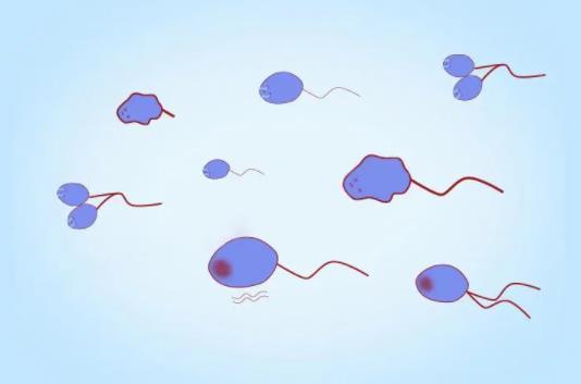 弱精引起的不孕问题应该如何应对，可根据原因进行具体治疗