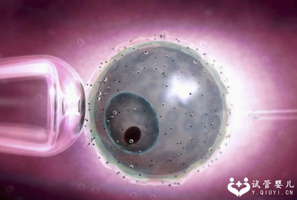 美国三代试管婴儿费用能达到多少？及成功率数据汇总