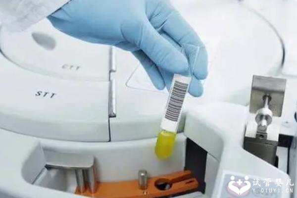 三代试管婴儿的操作流程是怎样的？总共分为四个步骤