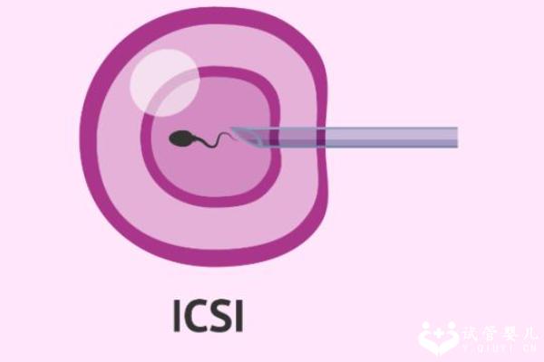 试管婴儿超详细流程讲解，开始到结束总共7步