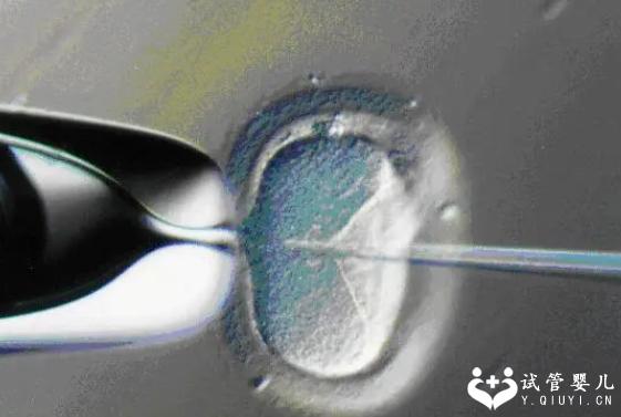 试管打促排卵针注意事项一览，这几个方面都别忽略