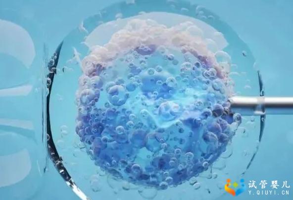 染色体平衡易位做三代试管成功率是多少？看真实数据知晓答案