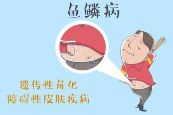 鱼鳞病可以通过做三代试管生出健康孩子，值得放心选择