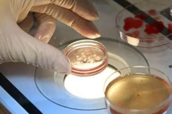 美国试管婴儿技术和国内三甲医院相比，哪个更好