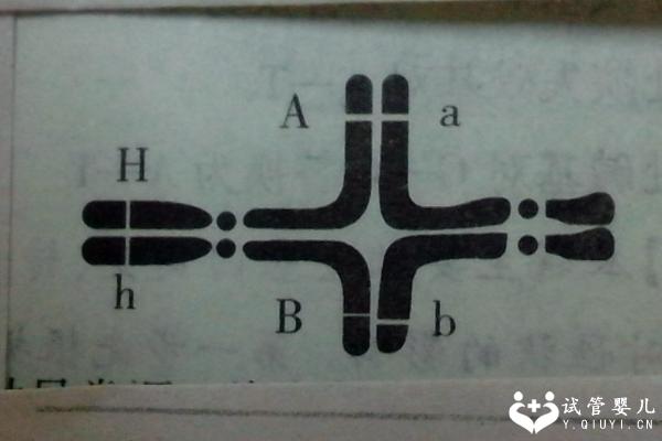 有染色体易位问题怎么办？三代试管能助你生下健康孩子