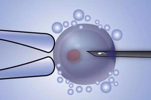 赴美试管费用预估，附项目费用清单