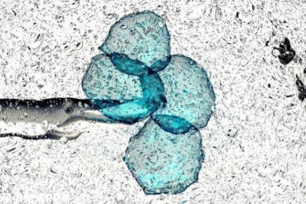 广东三代试管私立医院推荐,看看技术到底如何!