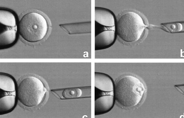 试管婴儿一次只能移植一个吗？揭秘胚胎移植的真相