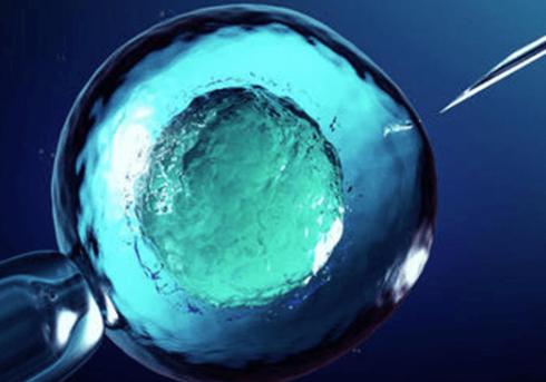 试管婴儿做了不用卧床休息吗？真相揭秘！