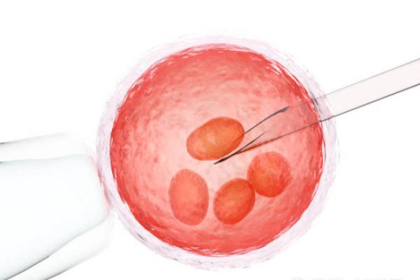 第二代试管婴儿费用高吗？全面解析其费用和流程