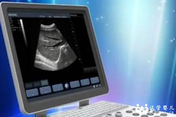 囊卵巢综合症做试管好吗？成功率怎么样？