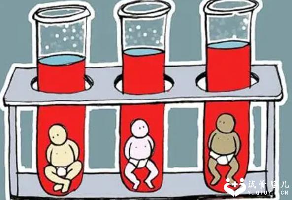 单侧巧克力囊肿试管能成功吗？试管时要注意什么？