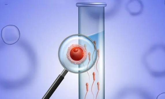 女性选择试管促排长方案和短方案哪种刺激更小？