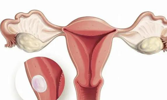 自己体内膜粘连如何提高试管成功吗？试管前要注意什么？
