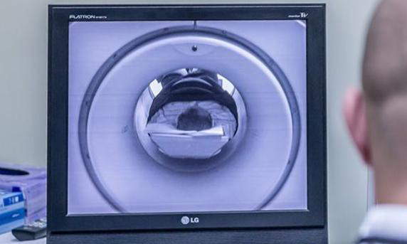 管腔粘连在广医三院做试管婴儿成功率高不高？