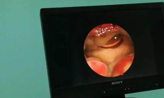 试管婴儿成功建档后还需要等多久再进行胚胎移植？