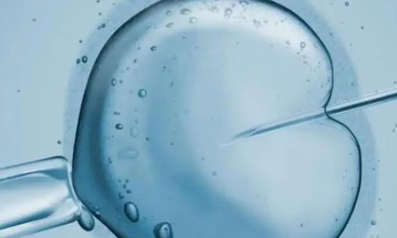 做试管婴儿取卵手术需要打麻药吗？