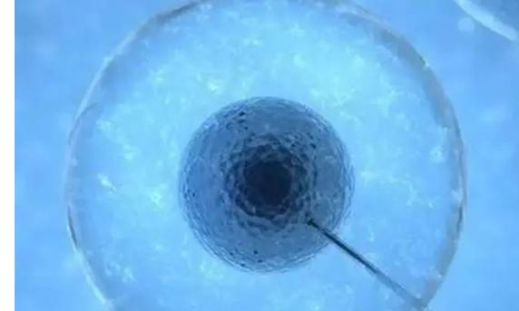 试管婴儿养囊的价格是多少？