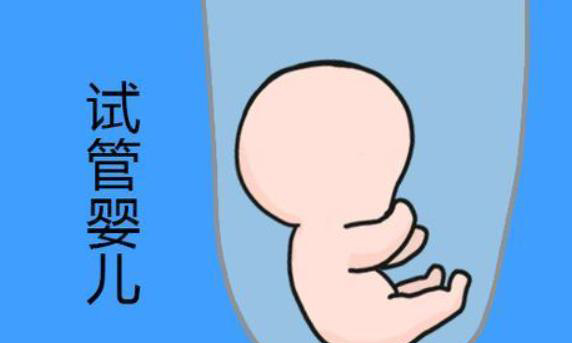 试管婴儿的签约套餐是否安全可靠?