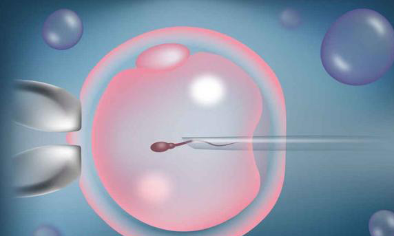 做试管婴儿移植手术后多久可以坐高铁?