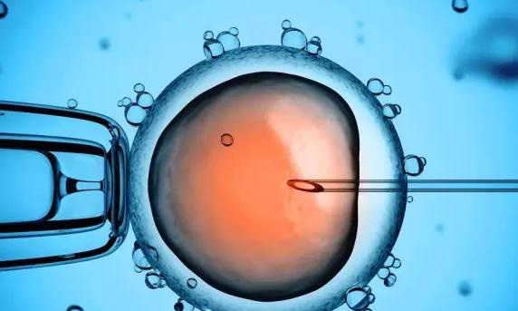 做完试管促排雌二醇水平达到4500,这个数值正常吗?