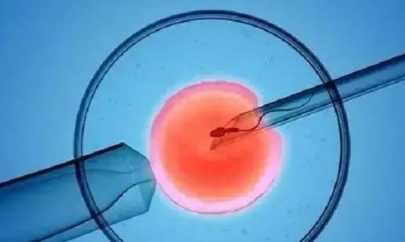 做试管移植手术需要夫妻双方都在现场不？